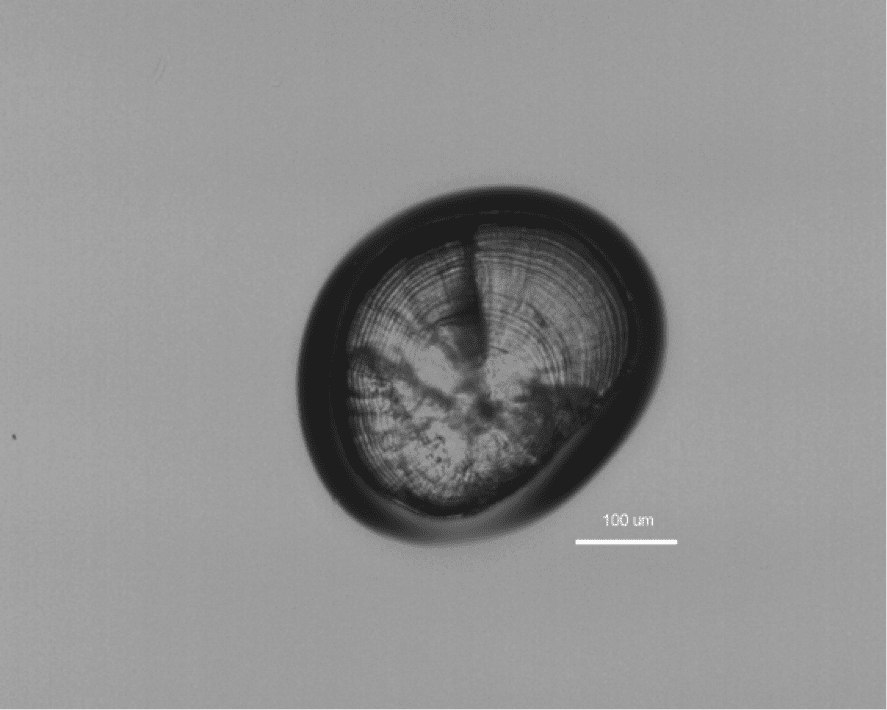 Typical light-dark transitions in a lapillus that are counted to determine a fish’s daily age.